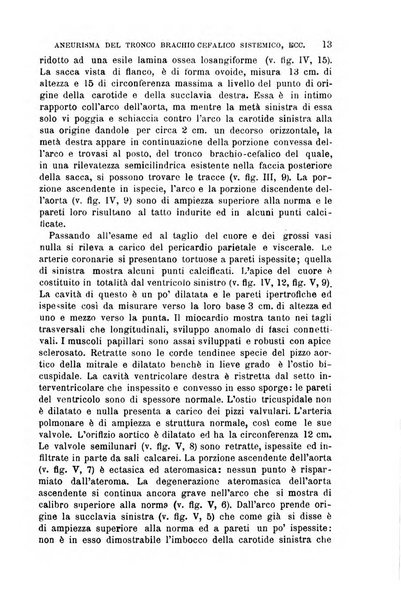 Il morgagni giornale indirizzato al progresso della medicina. Parte 1., Archivio o Memorie originali