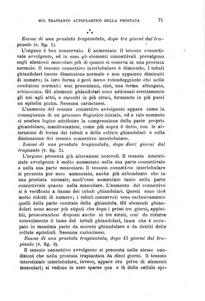 Il morgagni giornale indirizzato al progresso della medicina. Parte 1., Archivio o Memorie originali