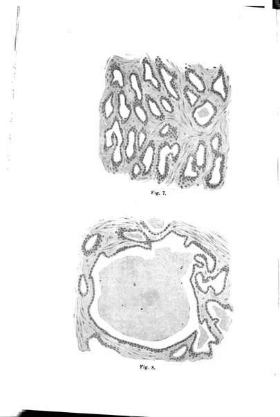 Il morgagni giornale indirizzato al progresso della medicina. Parte 1., Archivio o Memorie originali