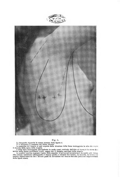 Il morgagni giornale indirizzato al progresso della medicina. Parte 1., Archivio o Memorie originali