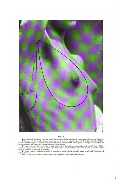 Il morgagni giornale indirizzato al progresso della medicina. Parte 1., Archivio o Memorie originali