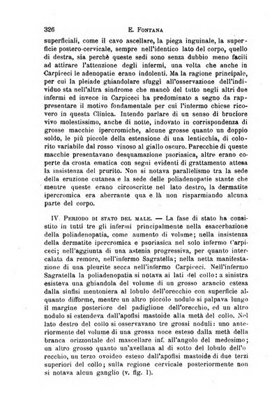 Il morgagni giornale indirizzato al progresso della medicina. Parte 1., Archivio o Memorie originali