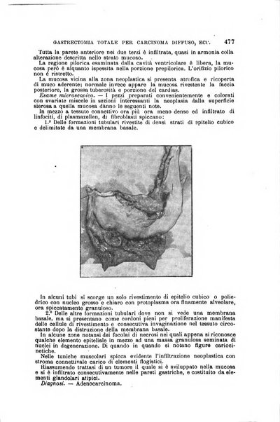 Il morgagni giornale indirizzato al progresso della medicina. Parte 1., Archivio o Memorie originali