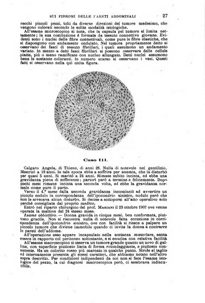 Il morgagni giornale indirizzato al progresso della medicina. Parte 1., Archivio o Memorie originali