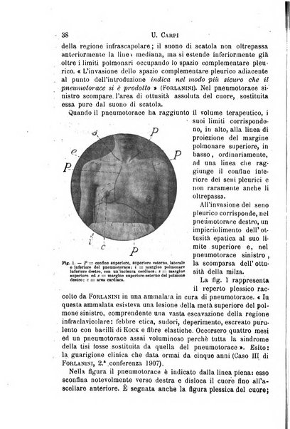 Il morgagni giornale indirizzato al progresso della medicina. Parte 1., Archivio o Memorie originali