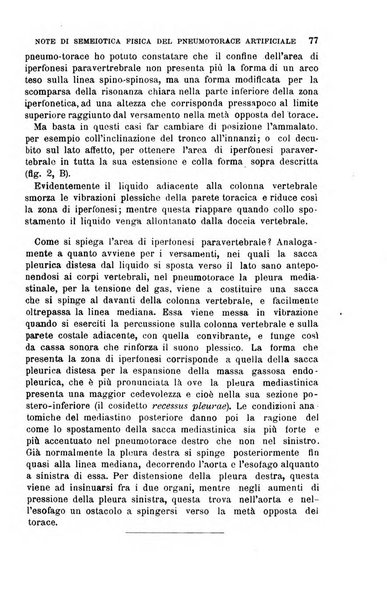 Il morgagni giornale indirizzato al progresso della medicina. Parte 1., Archivio o Memorie originali