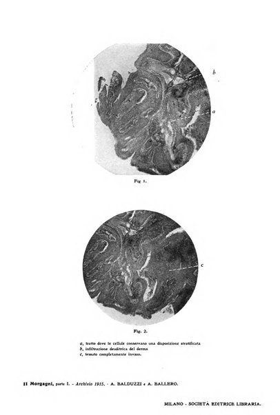 Il morgagni giornale indirizzato al progresso della medicina. Parte 1., Archivio o Memorie originali