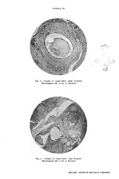 Il morgagni giornale indirizzato al progresso della medicina. Parte 1., Archivio o Memorie originali