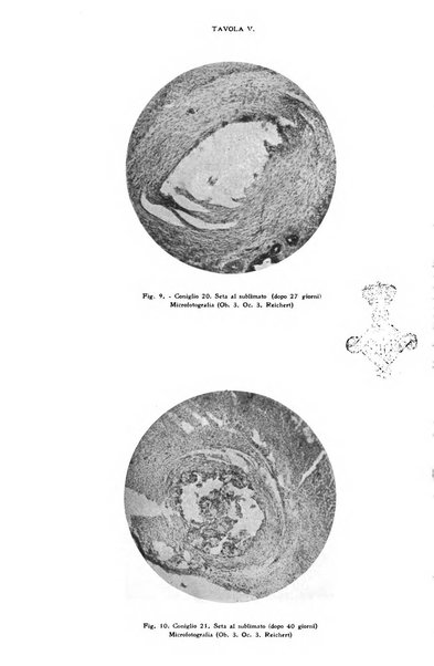 Il morgagni giornale indirizzato al progresso della medicina. Parte 1., Archivio o Memorie originali