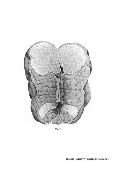 Il morgagni giornale indirizzato al progresso della medicina. Parte 1., Archivio o Memorie originali