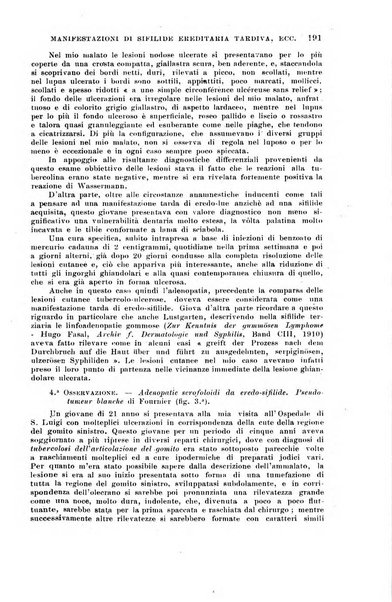 Il morgagni giornale indirizzato al progresso della medicina. Parte 1., Archivio o Memorie originali