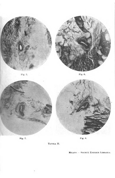 Il morgagni giornale indirizzato al progresso della medicina. Parte 1., Archivio o Memorie originali