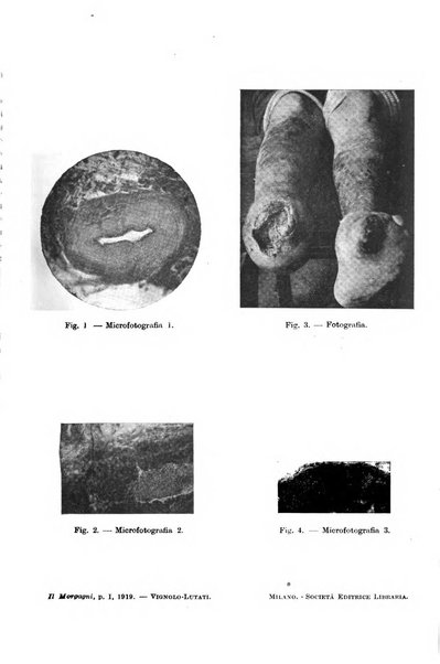 Il morgagni giornale indirizzato al progresso della medicina. Parte 1., Archivio o Memorie originali