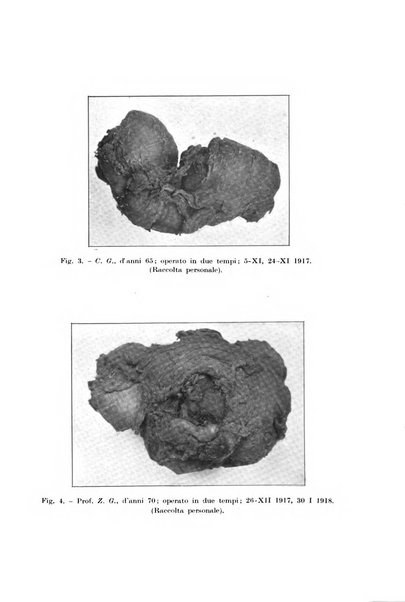 Il morgagni giornale indirizzato al progresso della medicina. Parte 1., Archivio o Memorie originali