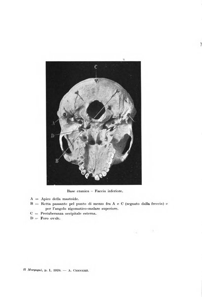 Il morgagni giornale indirizzato al progresso della medicina. Parte 1., Archivio o Memorie originali