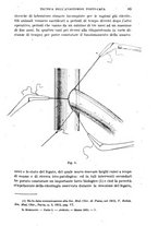 giornale/NAP0034716/1921/unico/00000107