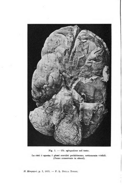 Il morgagni giornale indirizzato al progresso della medicina. Parte 1., Archivio o Memorie originali