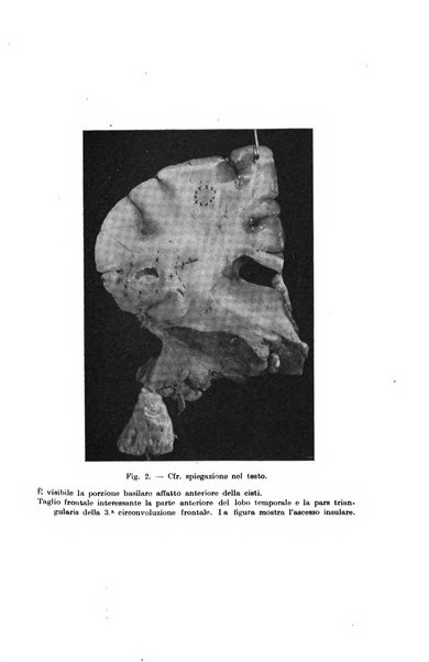 Il morgagni giornale indirizzato al progresso della medicina. Parte 1., Archivio o Memorie originali