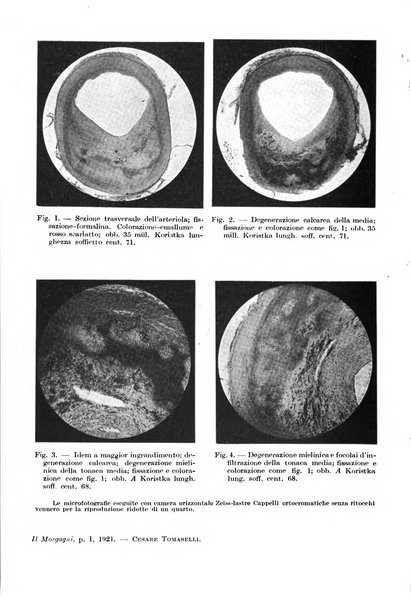 Il morgagni giornale indirizzato al progresso della medicina. Parte 1., Archivio o Memorie originali