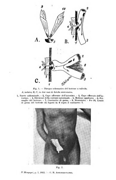 Il morgagni giornale indirizzato al progresso della medicina. Parte 1., Archivio o Memorie originali