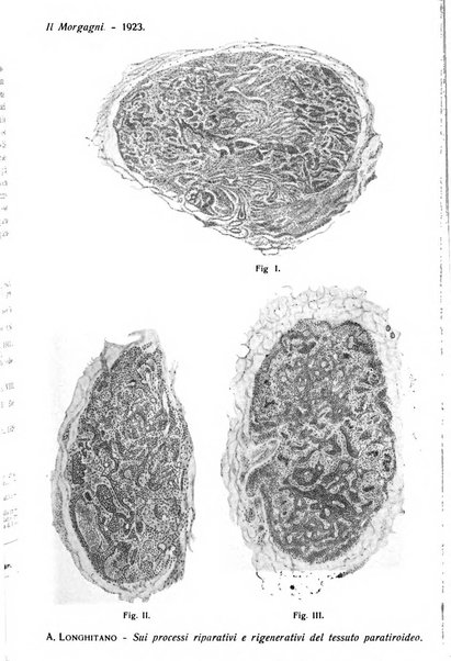 Il morgagni giornale indirizzato al progresso della medicina. Parte 1., Archivio o Memorie originali