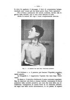 giornale/NAP0034872/1929/P.2/00000676