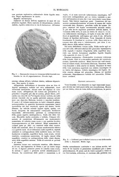 Il morgagni rivista settimanale