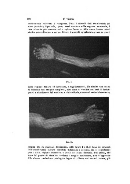 Rivista di neurologia