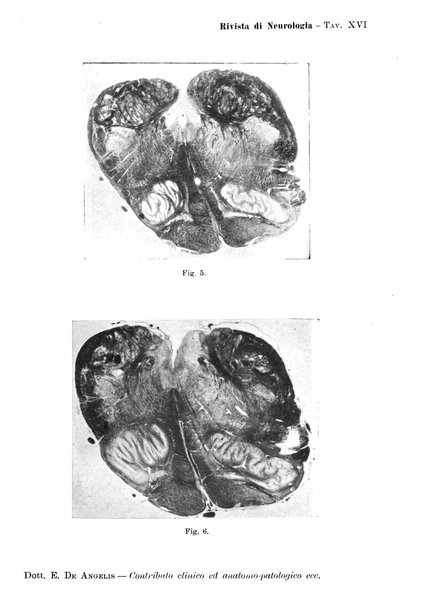 Rivista di neurologia