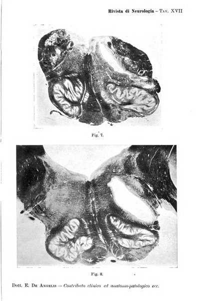 Rivista di neurologia