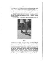 giornale/NAP0076295/1930/unico/00000096