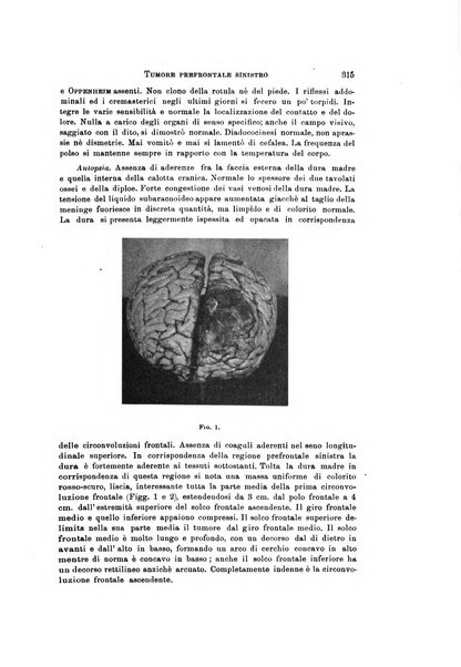 Rivista di neurologia