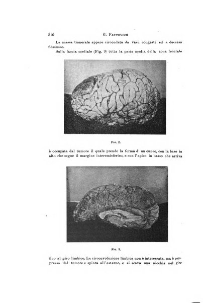 Rivista di neurologia