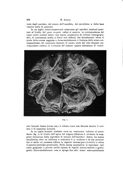 Rivista di neurologia