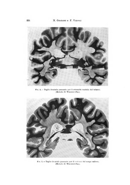 Rivista di neurologia