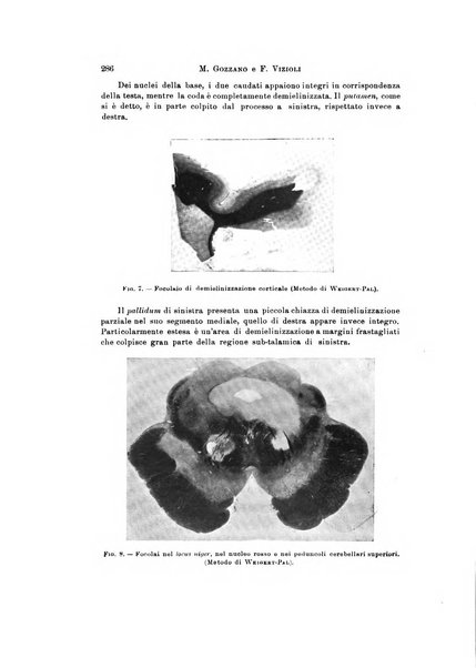 Rivista di neurologia