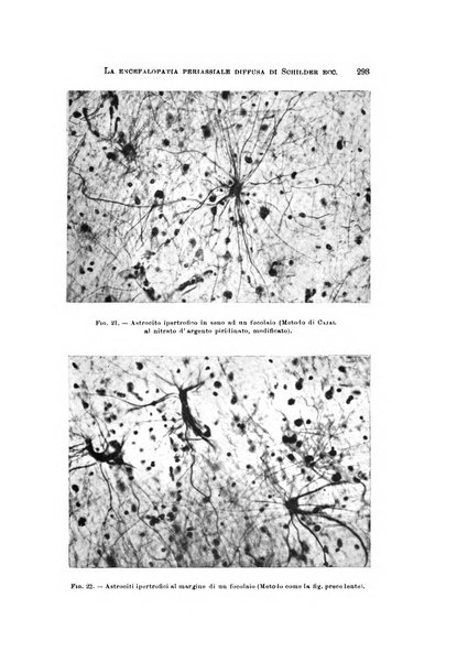 Rivista di neurologia