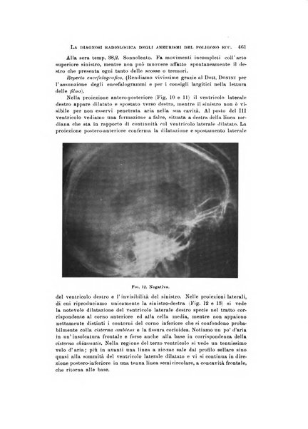 Rivista di neurologia