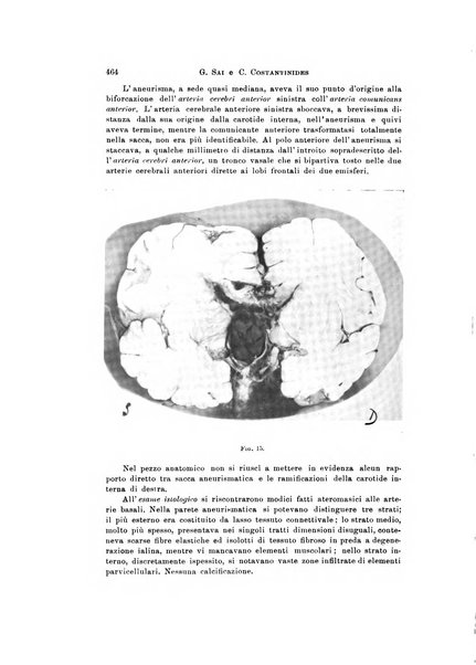 Rivista di neurologia