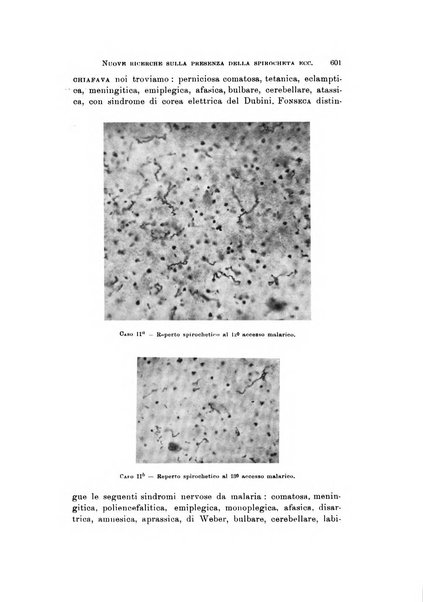 Rivista di neurologia