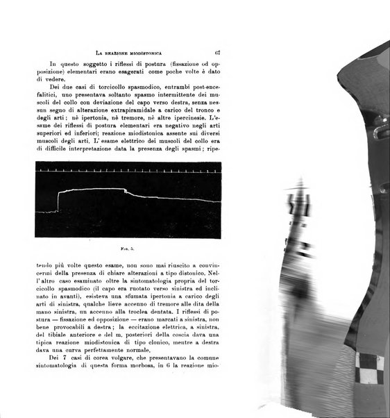 Rivista di neurologia