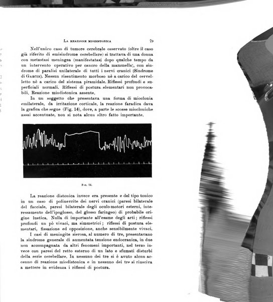 Rivista di neurologia