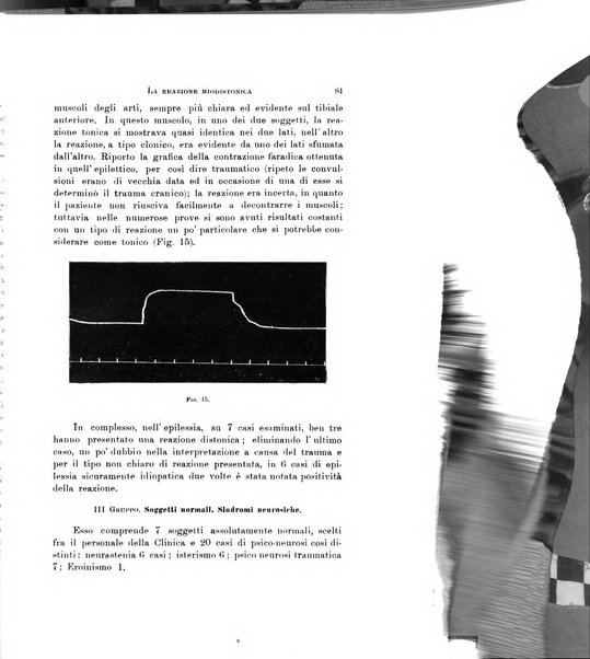 Rivista di neurologia