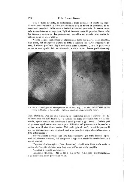 Rivista di neurologia