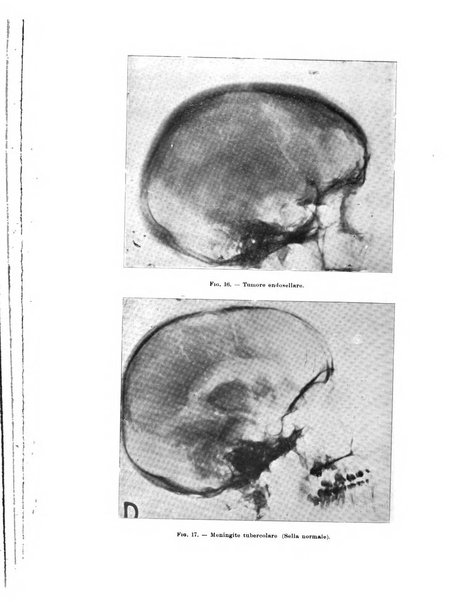 Rivista di neurologia