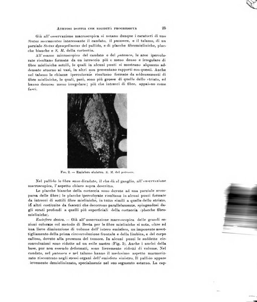 Rivista di neurologia