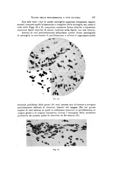 Rivista di neurologia