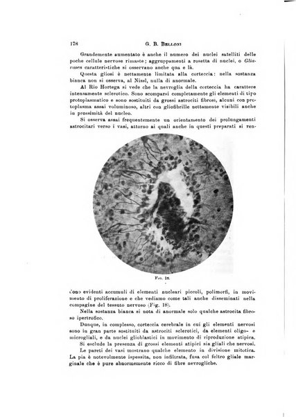 Rivista di neurologia