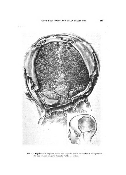 Rivista di neurologia