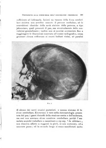 Rivista di neurologia